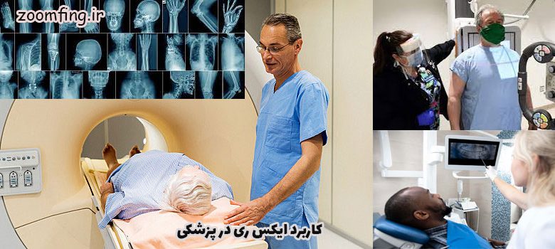 ایکس-ری-در-پزشکی